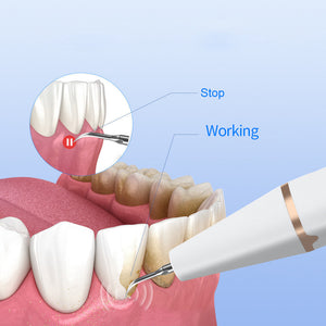 3 Speed Ultrasonic Electric Dental Cleaner With Led Light And Type Charging Professional Plaque Remover Kit